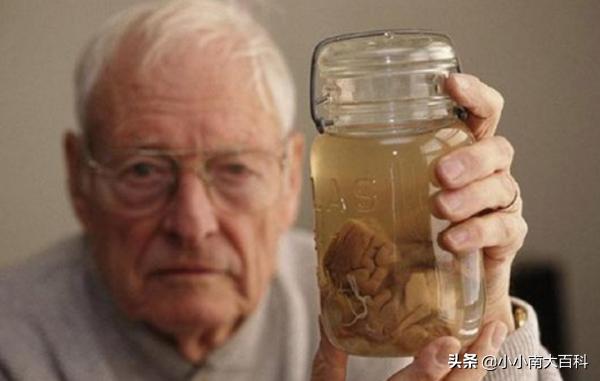 爱因斯坦脑子切开后（爱因斯坦脑子切开后怎么样了）